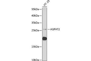 Western blot analysis of extracts of HT-29 cells, using  antibody (ABIN6129825, ABIN6136640, ABIN6136641 and ABIN6222174) at 1:1000 dilution. (AGPAT2 antibody  (AA 199-278))