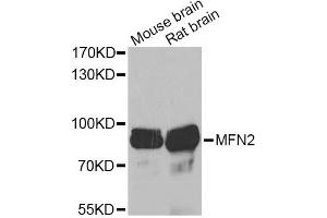 Western blot analysis of extracts of various cell lines, using MFN2 Antibody (ABIN6290636) at 1:1000 dilution. (MFN2 antibody)