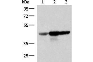 Western blot analysis of Human fetal brain tissue HepG2 and HT29 cell lysates using FDFT1 Polyclonal Antibody at dilution of 1:1000 (FDFT1 antibody)