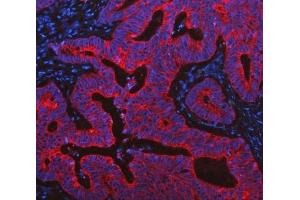 IF analysis of Cytokeratin 19 using anti-Cytokeratin 19 antibody (ABIN3043288). (Cytokeratin 19 antibody  (C-Term))