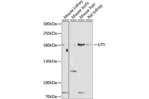 Western blot analysis of extracts of various cell lines, using UTY antibody (ABIN6132937, ABIN6150042, ABIN6150043 and ABIN6224660) at 1:1000 dilution. (UTY antibody  (AA 1-70))