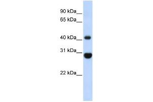 WB Suggested Anti-CNP Antibody Titration: 0. (Cnpase antibody  (Middle Region))