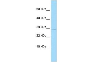 WB Suggested Anti-Cyb5d2 Antibody Titration: 0. (CYB5D2 antibody  (C-Term))