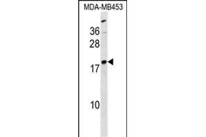 LYPLA1 Antibody (Center) (ABIN1538556 and ABIN2838111) western blot analysis in MDA-M cell line lysates (35 μg/lane). (LYPLA1 antibody  (AA 65-94))