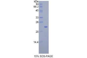 SDS-PAGE (SDS) image for Interleukin 17 Receptor B (IL17RB) (AA 166-354) protein (His tag) (ABIN2121417)
