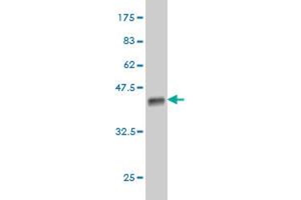 DOT1L antibody  (AA 3-108)