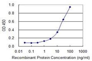 Detection limit for recombinant GST tagged SOX18 is 0. (SOX18 antibody  (AA 63-150))