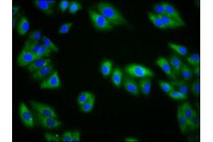 Immunofluorescence staining of HepG2 cells with ABIN7157546 at 1:133, counter-stained with DAPI. (KIRREL3 antibody  (AA 200-343))