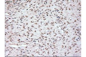 Immunohistochemistry (IHC) image for anti-Noggin (NOG) (AA 28-232) antibody (ABIN1491316) (NOG antibody  (AA 28-232))