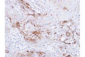 IHC-P Image Immunohistochemical analysis of paraffin-embedded Ca922 xenograft, using CD36, antibody at 1:500 dilution. (CD36 antibody  (C-Term))