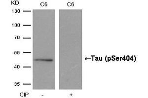 Western blot analysis of extracts from C6 cells, treated with calf intestinal phosphatase (CIP), using Tau (Phospho-Ser404) Antibody. (MAPT antibody  (pSer404))