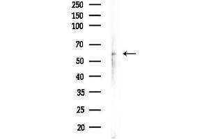 Western blot analysis of lysates from Rat brain, using Phospho-Tyrosine Hydroxylase (Ser40) Antibody at 1/1000 dilution.