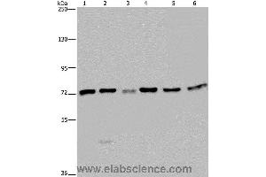 Western blot analysis of K562, A549, HT-29, 293T, Hela and Jurkat cell, using KARS Polyclonal Antibody at dilution of 1:350 (KARS antibody)