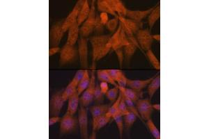 Immunofluorescence analysis of NIH-3T3 cells using K48-linkage Specific Ubiquitin Rabbit mAb (ABIN1680189, ABIN3017871, ABIN3017872 and ABIN7101530) at dilution of 1:100 (40x lens). (Ubiquitin B antibody)