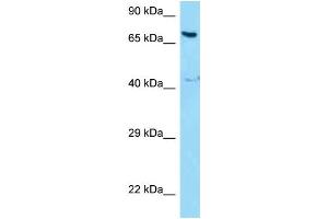 WB Suggested Anti-NCOA5 Antibody Titration: 1. (NCOA5 antibody  (Middle Region))