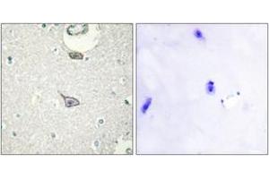Immunohistochemistry analysis of paraffin-embedded human brain tissue, using CADM4 Antibody. (Cell Adhesion Molecule 4 antibody  (AA 339-388))