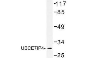 Image no. 1 for anti-Ring Finger Protein 144A (RNF144A) antibody (ABIN317831) (RNF144A antibody)