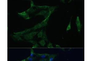 Immunofluorescence analysis of C6 cells using ARL3 Polyclonal Antibody at dilution of 1:100 (40x lens). (ARL3 antibody)