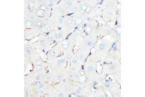 Immunohistochemistry (IHC) image for anti-Caveolin 1, Caveolae Protein, 22kDa (CAV1) (AA 1-100) antibody (ABIN6137992)