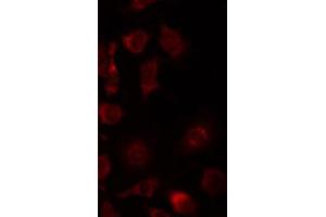 ABIN6267434 staining 293 by IF/ICC. (Synaptotagmin antibody  (pSer309))
