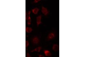 ABIN6267434 staining 293 by IF/ICC. (Synaptotagmin antibody  (pSer309))