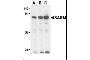 Western blot analysis of SARM in Daudi cell lysates with this product at (A) 0. (SARM1 antibody  (C-Term))