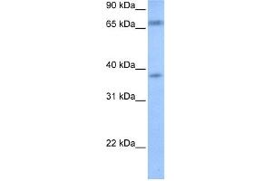 WB Suggested Anti-FEM1B Antibody Titration: 0. (FEM1B antibody  (Middle Region))