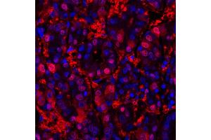 Immunofluorescence (IF) image for anti-Arginase, Liver (ARG1) (AA 1-322) antibody (ABIN7454020) (Recombinant Liver Arginase antibody  (AA 1-322))