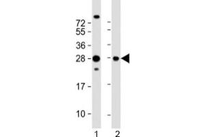 Western blot testing of 1) human HepG2 and 2) rat PC-12 cell lysate with PIMT antibody at 1:2000. (PCMT1 antibody  (AA 18-55))