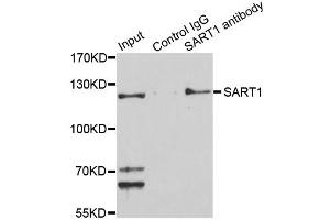 Immunoprecipitation analysis of 150ug extracts of Jurkat cells using 3ug SART1 antibody. (SART1 antibody)