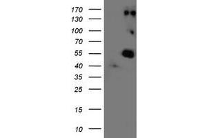 Western Blotting (WB) image for anti-Lysyl Oxidase (LOX) (AA 22-168) antibody (ABIN1491215)