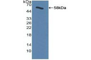 Western blot analysis of recombinant Human ADRbK1. (GRK2 antibody  (AA 398-640))