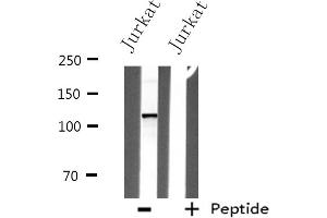 Western blot analysis of extracts from Jurkat cells, using ITPKB antibody. (ITPKB antibody  (Internal Region))