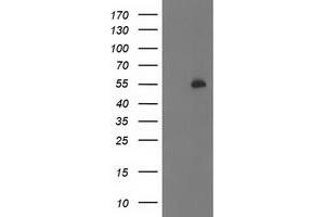 HEK293T cells were transfected with the pCMV6-ENTRY control (Left lane) or pCMV6-ENTRY PBX1 (Right lane) cDNA for 48 hrs and lysed. (PBX1 antibody)