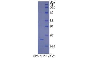 SDS-PAGE (SDS) image for Platelet-Derived Growth Factor C (PDGFC) (AA 235-345) protein (His tag) (ABIN1878489)