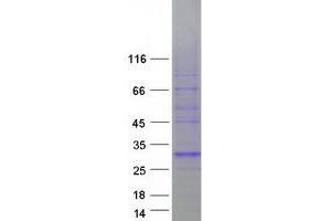 Western Blotting (WB) image for Basigin (Ok Blood Group) (BSG) (Transcript Variant 4) protein (Myc-DYKDDDDK Tag) (ABIN2713430)