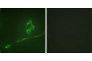Immunofluorescence analysis of NIH-3T3 cells, using p70 S6 Kinase (Ab-371) Antibody.