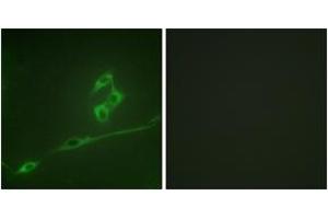 Immunofluorescence analysis of NIH-3T3 cells, using p70 S6 Kinase (Ab-371) Antibody. (RPS6KB1 antibody  (AA 337-386))