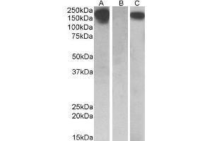 HEK293 lysate (10ug protein in RIPA buffer) overexpressing Human CSF1R with C-terminal MYC tag probed with ABIN2562031 (0.