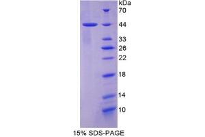 SDS-PAGE of Protein Standard from the Kit (Highly purified E. (Cytokeratin 7 ELISA Kit)