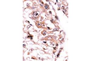 Image no. 2 for anti-Protein Phosphatase 3, Catalytic Subunit, gamma Isozyme (PPP3CC) (AA 480-509), (C-Term) antibody (ABIN360813) (PPP3CC antibody  (C-Term))