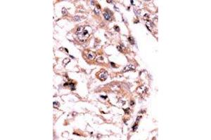 Image no. 2 for anti-Protein Phosphatase 3, Catalytic Subunit, gamma Isozyme (PPP3CC) (AA 480-509), (C-Term) antibody (ABIN360813)