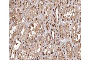 ABIN6267600 at 1/200 staining human kidney tissue sections by IHC-P. (NF-kB p65 antibody  (pThr254))