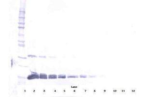 Image no. 2 for anti-Vascular Endothelial Growth Factor A (VEGFA) antibody (ABIN465469) (VEGFA antibody)
