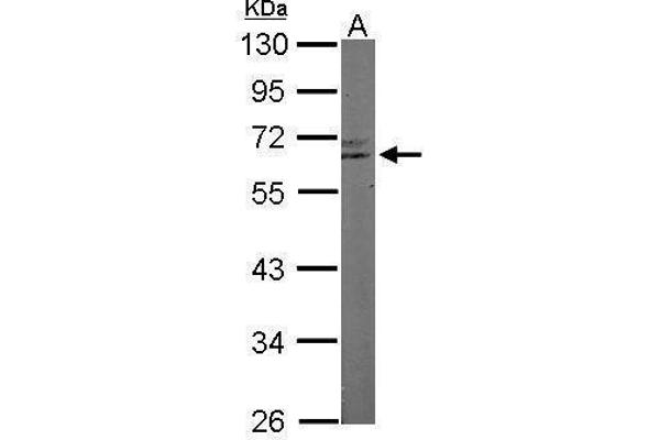 RAP1 antibody  (Center)