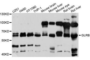 Western blot analysis of extracts of various cells, using GLRB antibody. (GLRB antibody)