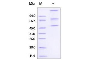 Human ADAM8, His Tag on SDS-PAGE under reducing (R) condition. (ADAM8 Protein (AA 17-497) (His tag))