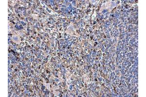 IHC-P Image beta Tubulin antibody detects beta Tubulin protein at cytoplasm in rat spleen by immunohistochemical analysis. (TUBB antibody)