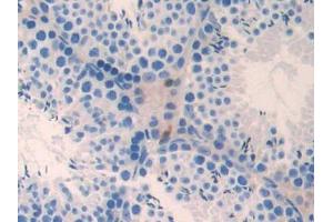 DAB staining on IHC-P; Samples: Mouse Testis Tissue (NME3 antibody  (AA 2-169))
