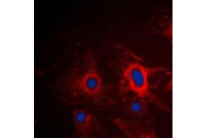 Immunofluorescent analysis of iNOS staining in A549 cells. (NOS2 antibody  (C-Term))